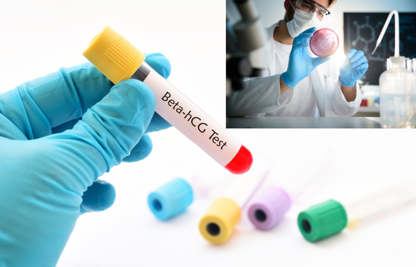 Beta hCG Test 